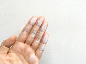 壁に触れた手のひらに残る真っ白な粉