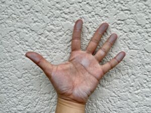 外壁劣化・チョーキングの確認
